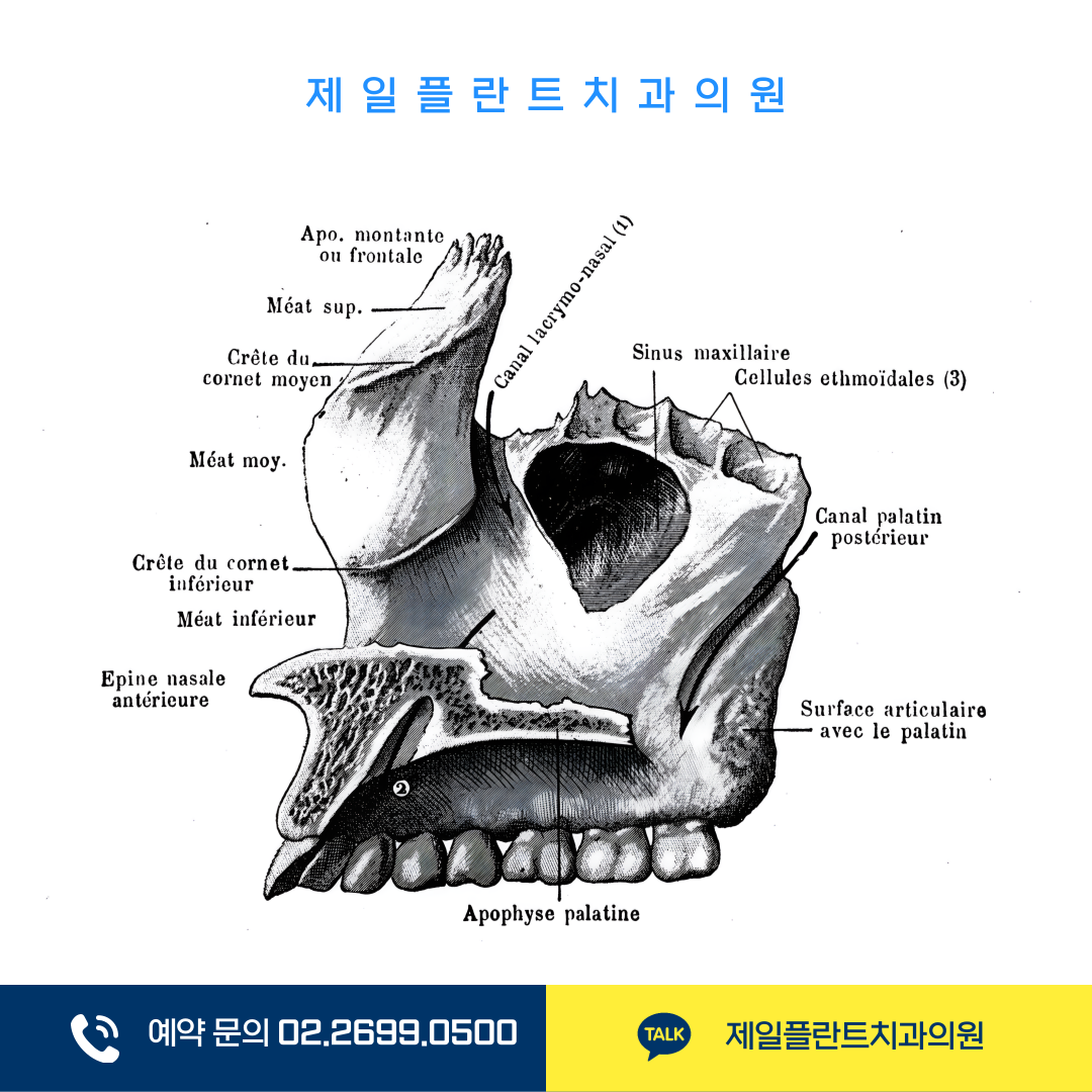 강서구치과 상악동거상술·임플란트뼈이식 핵심 판단 기준