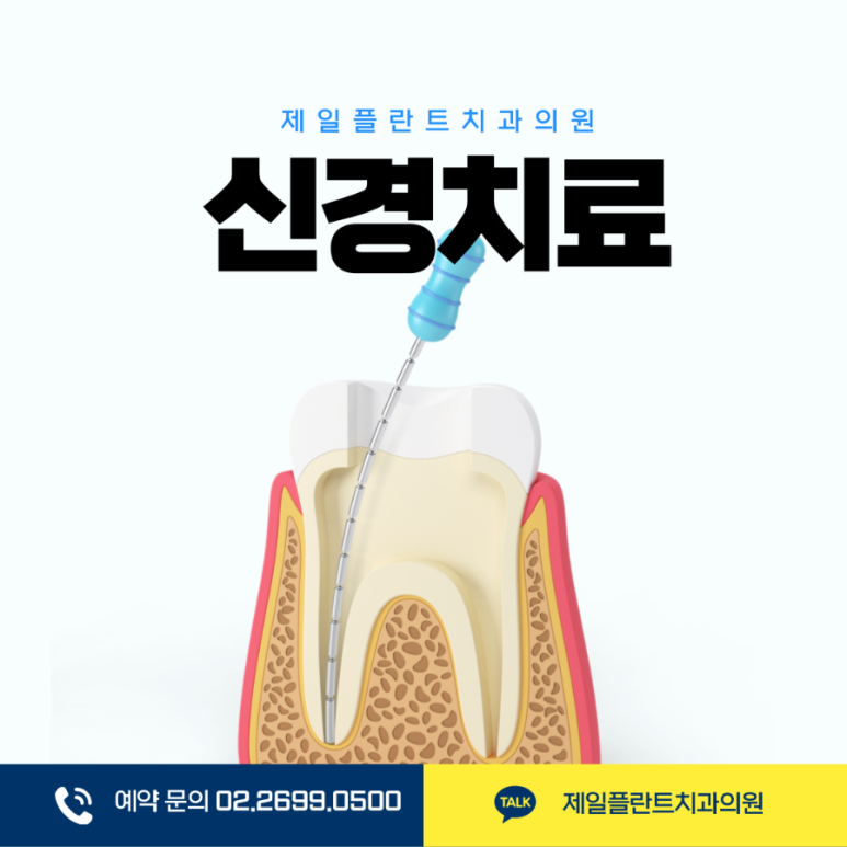 신경치료 후 주의사항 및 통증 관리 방법: 회복기 음식 섭취와 관리 팁