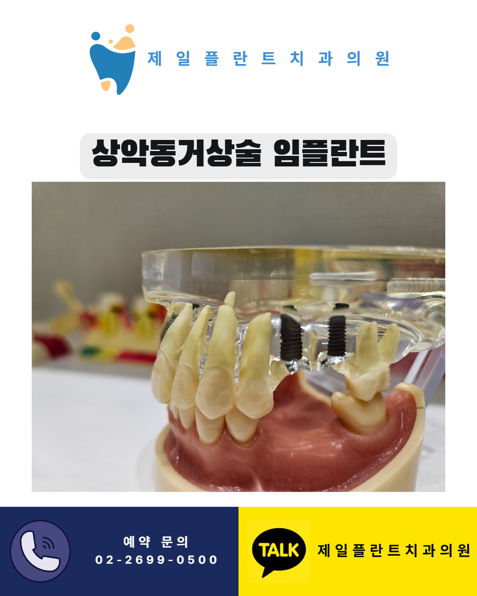 상악동거상술 임플란트 비용과 필요성 판단