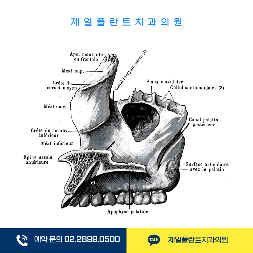 강서구치과 상악동거상술·임플란트뼈이식 핵심 판단 기준