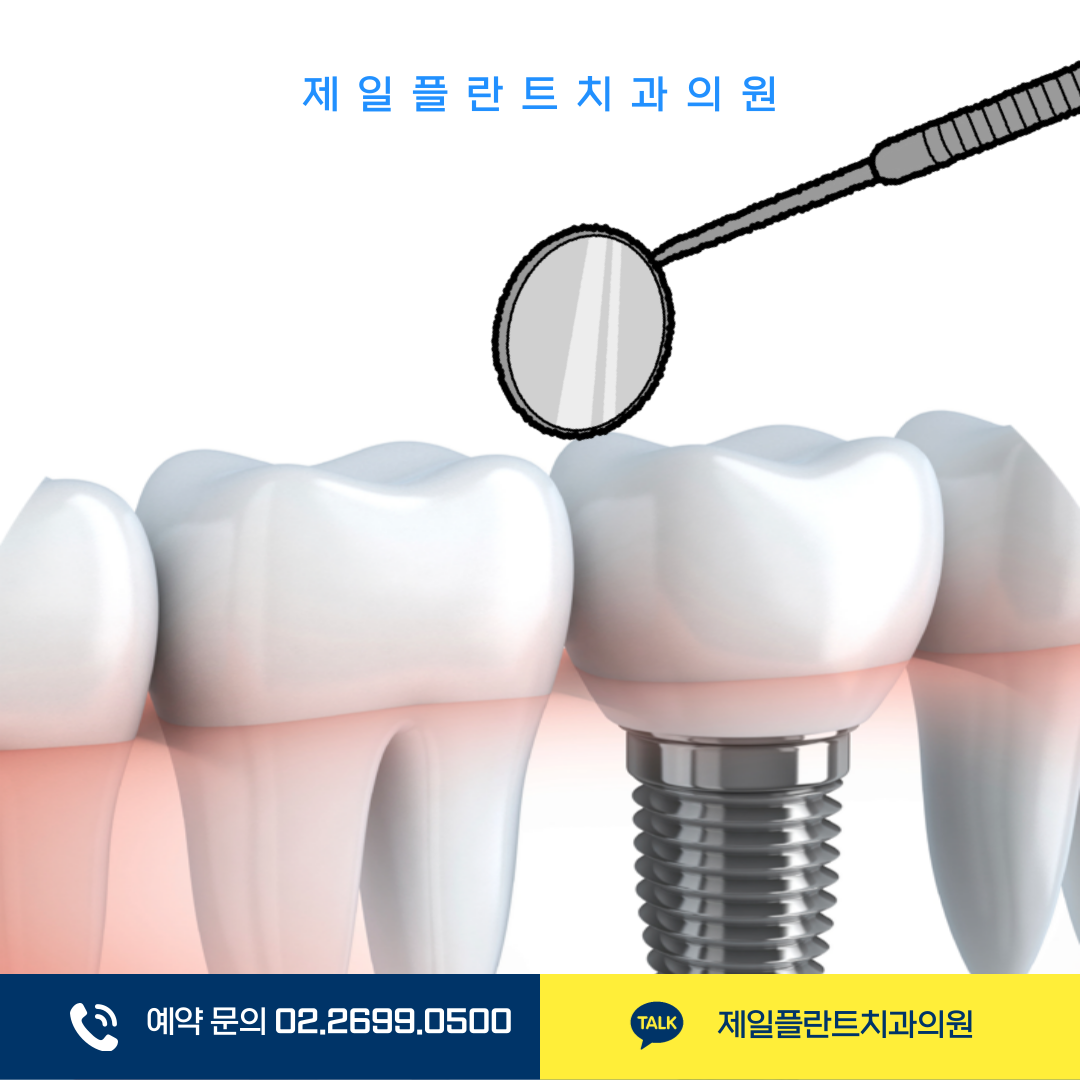 임플란트 수술 후 관리와 주의사항: 성공적인 회복을 위한 필수 체크